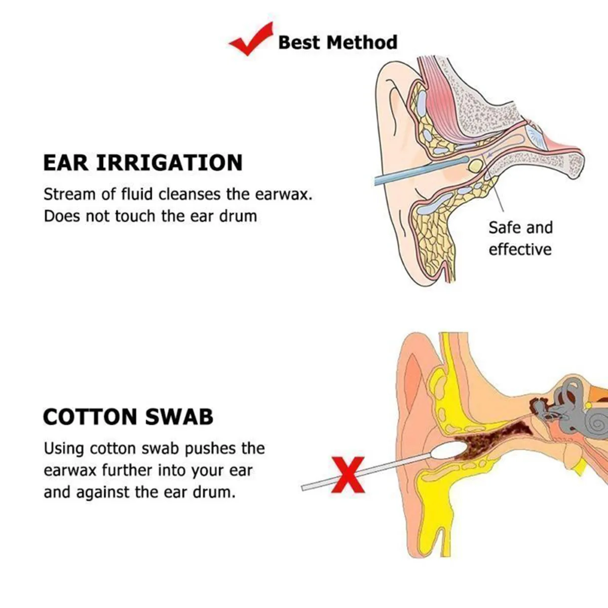 Ear Wax Removal Kit Ear Irrigation Ear Washer Bottles System For Ear Cleaning Tools Set + 5 Tips