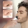 KONKA KBMQ-2502-L Elektrische Neushaartrimmer Achieve Shaver Gezichtsneushaarschaar Mannen Vrouwen Reiniging Trimmer Scheerapparaat